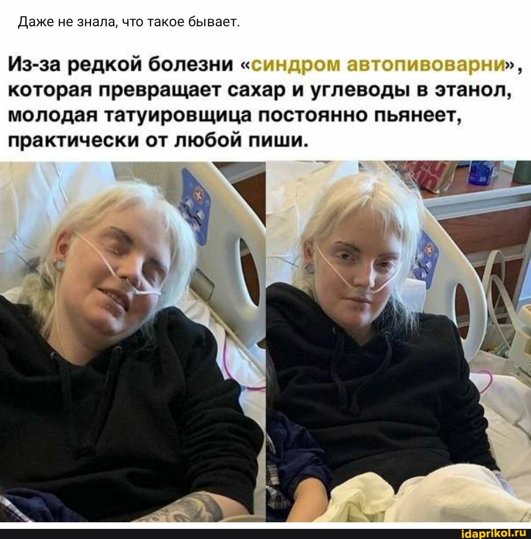 Даже не знала, что такое бывает.
Из-за редкой болезни "синдром автог которая превращает сахар и углеводы в этанол, молодая татуировщица постоянно пьянеет, практически от любой пиши.