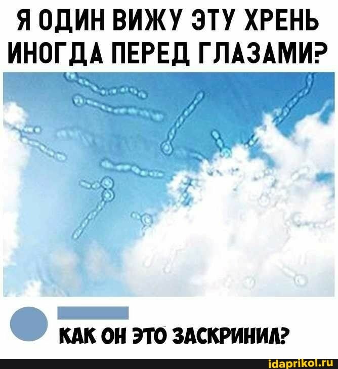Я ОДИН ВИЖУ ЭТУ ХРЕНЬ ИНОГДА ПЕРЕД ГЛАЗАМИ?
КАК ОН ЭТО ЗАСКРИНИЛ?
