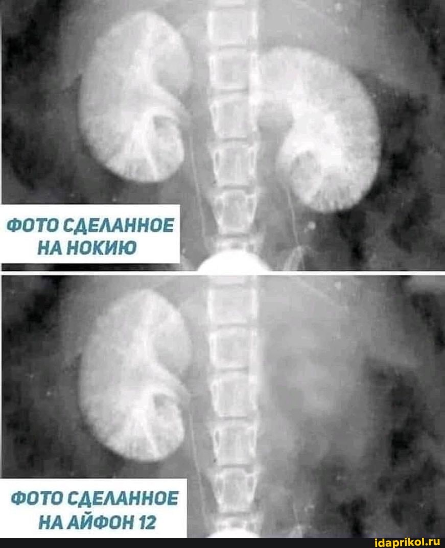ФОТО СДЕЛАННОЕ
НА НОКИЮ
ФОТО СДЕЛАННОЕ НА АИФОН 12