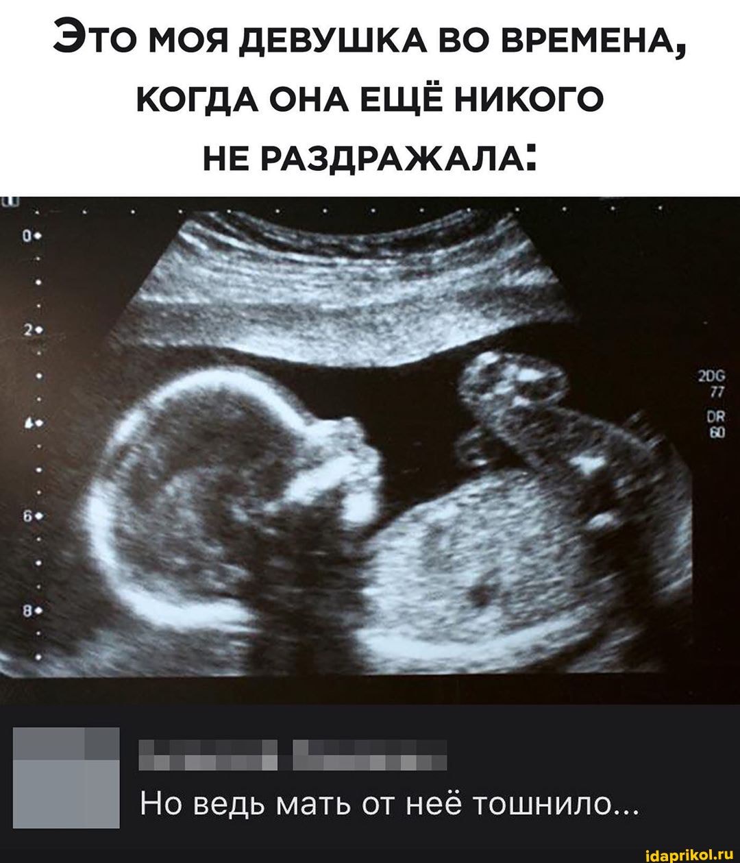 Это моя ДЕВУШКА ВО ВРЕМЕНА,
КОГДА ОНА ЕЩЁ НИКОГО
НЕ РАЗДРАЖАЛА.
Ш и Шиш
Но ведь мать от неё тошнило...