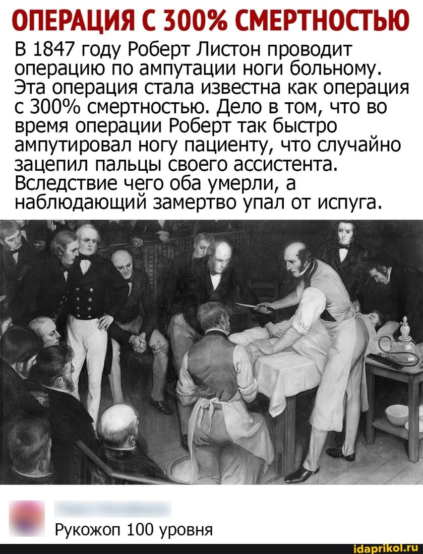 ОПЕРАЦИЯ С 300% СМЕРТНОСТЬЮ
В 1847 году Роберт Листон проводит операцию по ампутации ноги больному.
Эта операция стала известна как операция с 300% смертностью. Дело в том, что во время операции Роберт так быстро ампутировал ногу пациенту, что случайно зацепил пальцы своего ассистента.
Вследствие чего оба умерли, а наблюдающий замертво упал от испуга.
9 Рукожоп 100 уровня