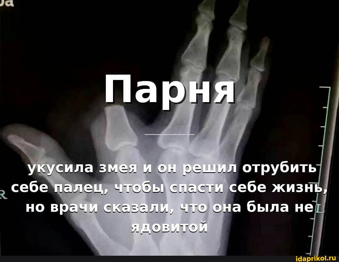 Парня
укусила змея и он решил отрубить себе палец, чтобы спасти себе жизнь, но врачи сказали, что она была не
ЯДОВИТОЙ