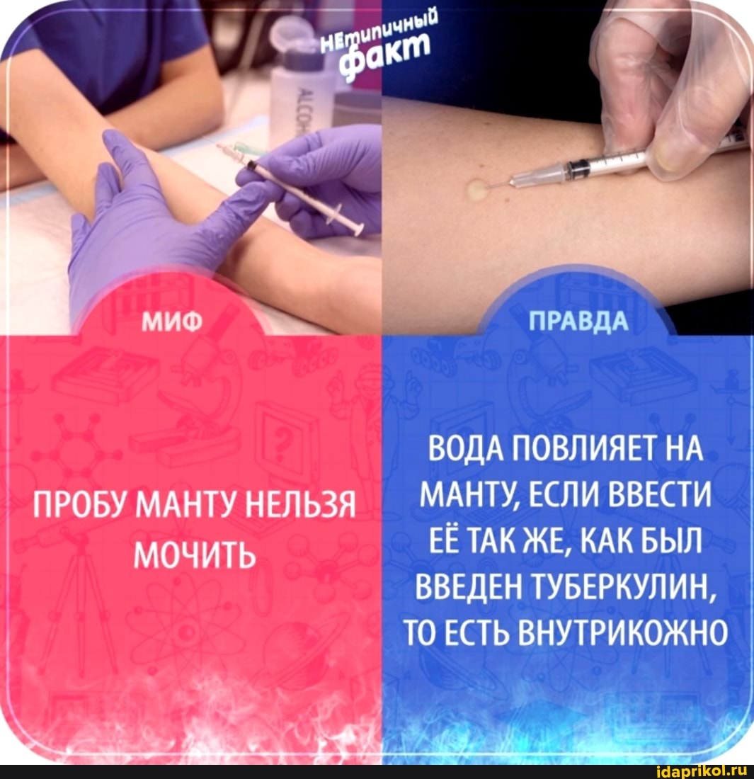 нЕ
ПРАВДА
ВОДА ПОВЛИЯЕТ НА ПРОБУ МАНТУ НЕЛЬЗЯ МАНТУ ЕСЛИ ВВЕСТИ МОЧИТЬ ЕЁ ТАК ЖЕ, КАК БЫЛ ВВЕДЕН ТУБЕРКУЛИН,
ТО ЕСТЬ ВНУТРИКОЖНО