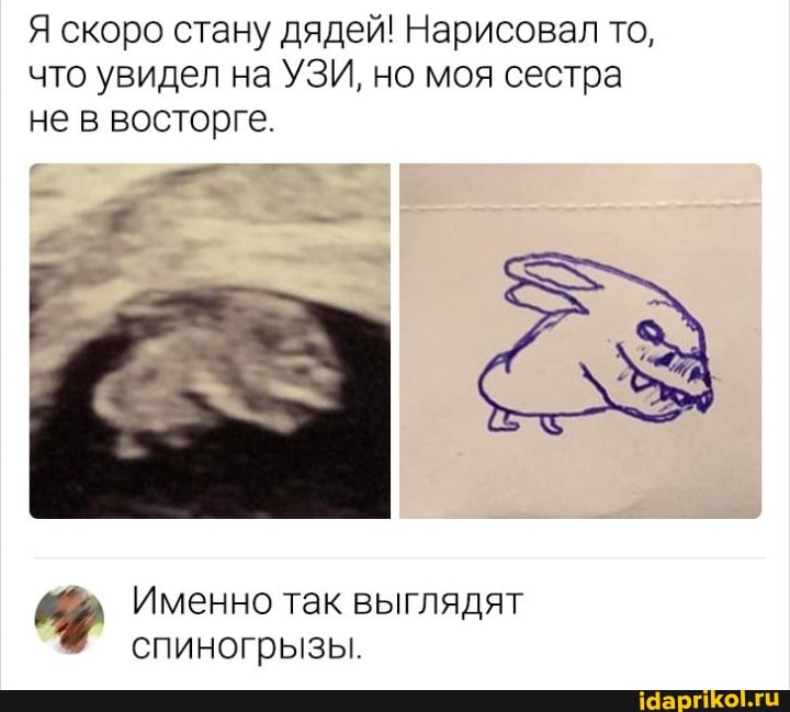 Я скоро стану дядей! Нарисовал то, что увидел на УЗИ, но моя сестра не в восторге.
Именно так выглядят спиногрызы.
